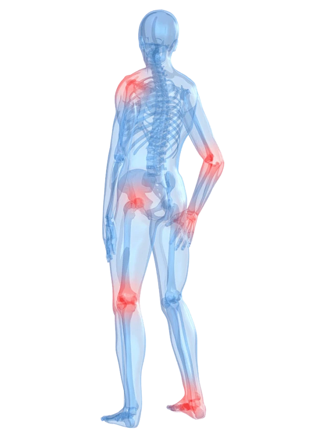 【PNG素材网-png.mixinnet.cn】名医在线 | 宋圣阁:寒冷冬季,保护好您的关节_运动