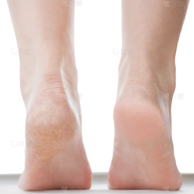 【PNG素材网-png.mixinnet.cn】人体部位写实脚部干燥特写对比