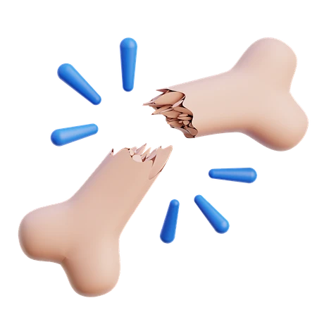 【PNG素材网-png.mixinnet.cn】PNG素材：骨折